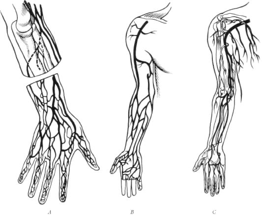 arteries and veins of hand and arm. C, arteries of the arm.