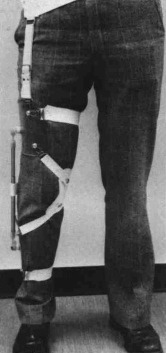 Fig. 4. CARSUBC Knee Orthosis O&P Digital Resource Library