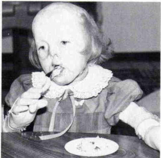 Figure 30. The use of cylindrical grasp on fee O&P Digital Resource