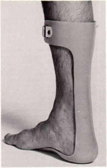 Fig. 2. Teufel Ortholene ankle-foot orthosis. | O&P Digital Resource ...